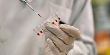 Un investigador manipula material de laboratorio.© Fundación "la Caixa"