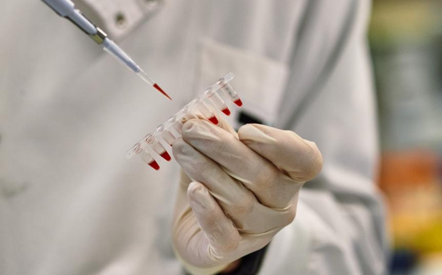 Un investigador manipula material de laboratorio.© Fundación "la Caixa"