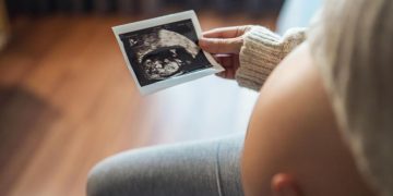 Mujer embarazada que mira su informe de ultrasonido.© Shutterstock / oatawa