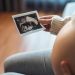 Mujer embarazada que mira su informe de ultrasonido.© Shutterstock / oatawa